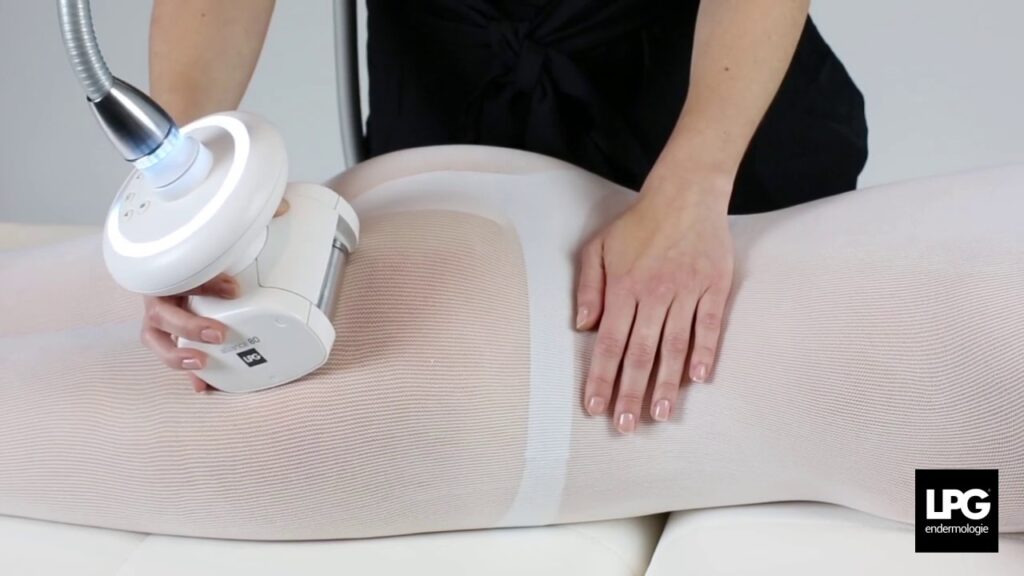 LPG Endermologie non-invasive technology to help you to smoother and firmer skin