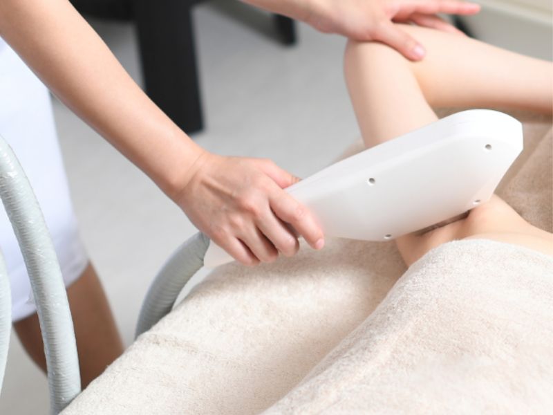 Best IPL treatment Brisbane