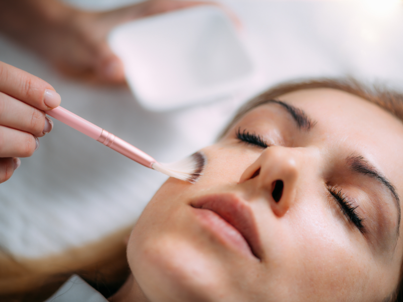 Why Chemical Peels - Skin Resurfacing & Fine Line Treatment