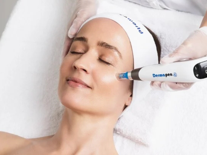 DermaPen MicroNeedling Non-invasive Anti-aging Treatment - 
Facial Rejuvenation Without Injectables - Wrinkle treatments