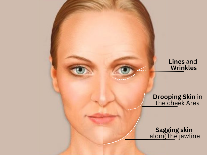 Typical Signs of The Natural Aging Process